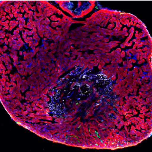 Cropped Cropped Advreg