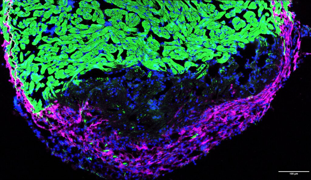 sjr9 tcf21 mcherry mf20 dapi ++