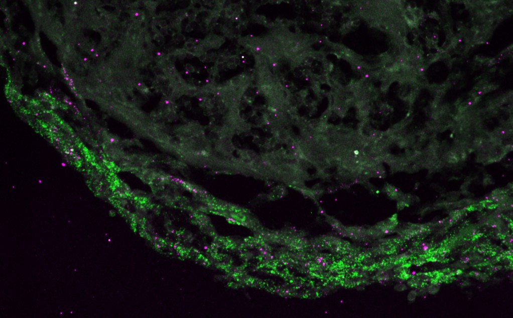 sulf1 hcr 4dpci 2 sulf1 raldh1a2